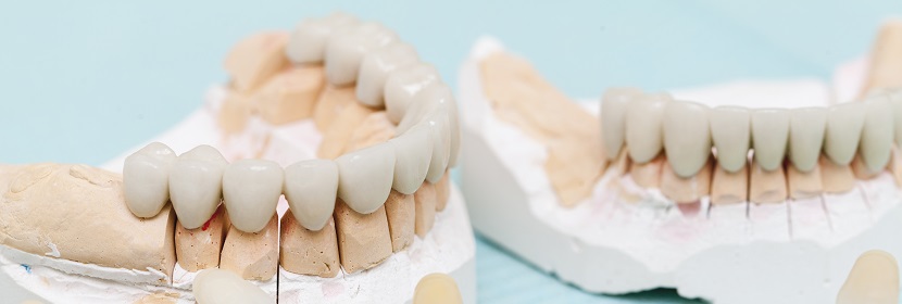 界面彎曲強(qiáng)度