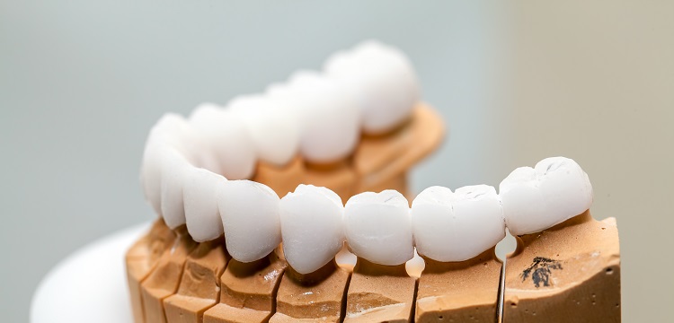 彎曲復(fù)原試驗(yàn)