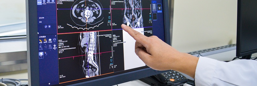 X射線計(jì)算機(jī)體層攝影(CT)裝置放射衛(wèi)生檢測(cè)評(píng)價(jià)