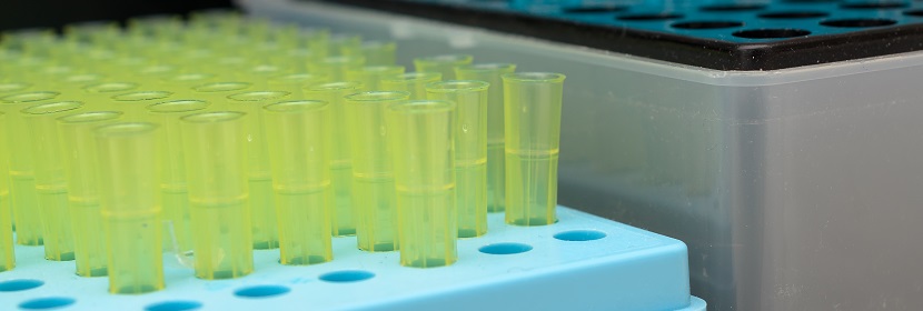 工業用三氯氧磷檢測